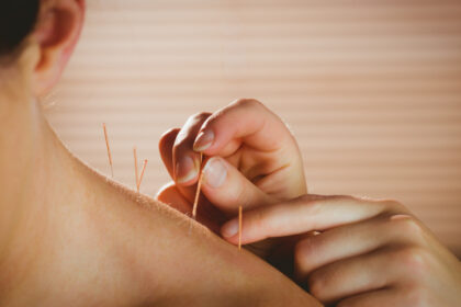 Cabinet d’acupuncture : quand et pourquoi consulter un acupuncteur ?