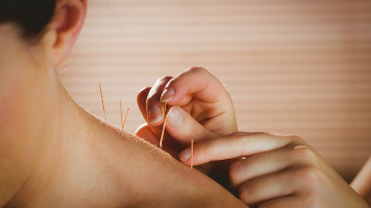 Cabinet d’acupuncture : quand et pourquoi consulter un acupuncteur ?